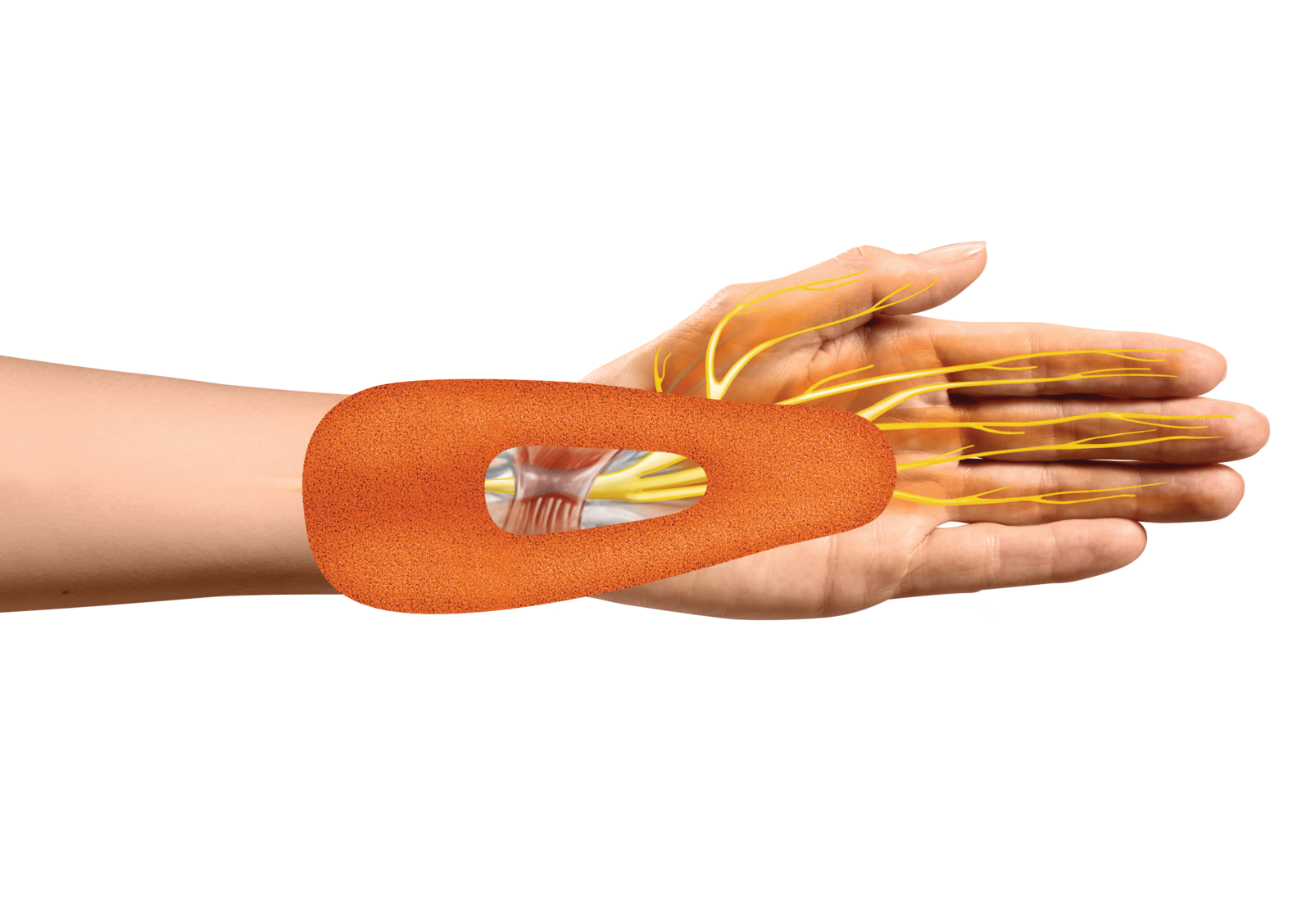 Carpal Tunnel Syndrome Support
